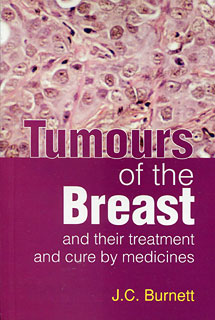 Tumours of the Breast/James Compton Burnett