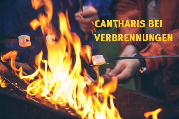 Cantharis bei Verbrennungen